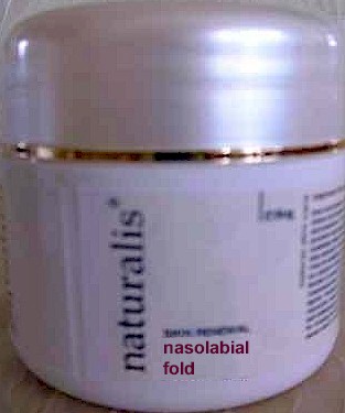 Nasolabial Fold Treatment